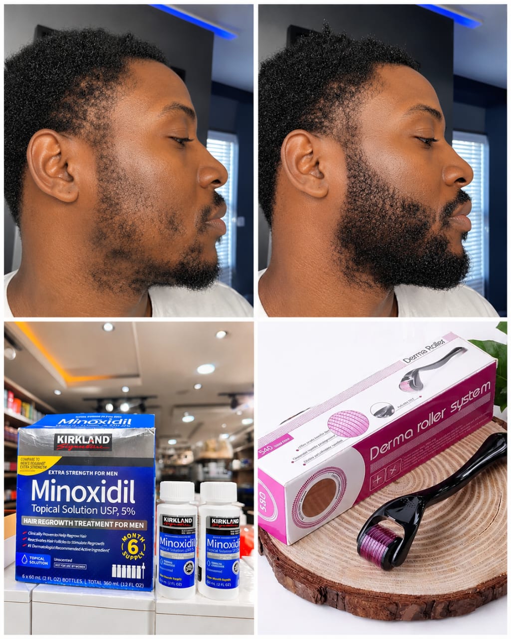 Kit repousse de cheveux 2