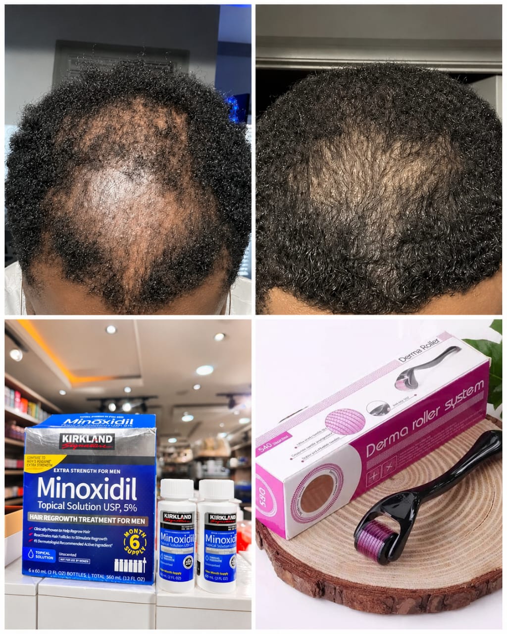 Kit repousse de cheveux 4